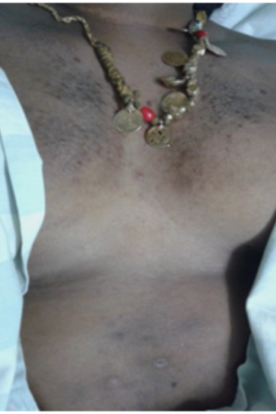wellcare international hospital trichy wellcare international hospital trichy