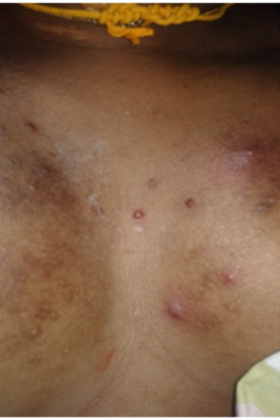 wellcare international hospital trichy wellcare international hospital trichy