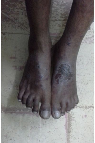 wellcare international hospital trichy wellcare international hospital trichy
