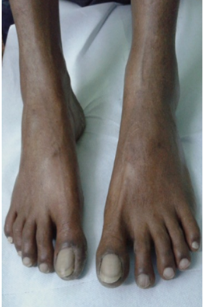 wellcare international hospital trichy wellcare international hospital trichy