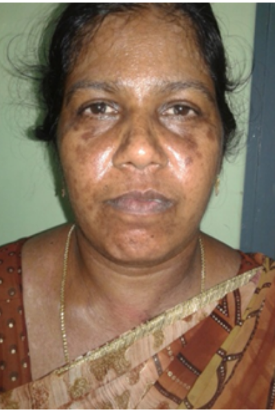 wellcare international hospital trichy wellcare international hospital trichy