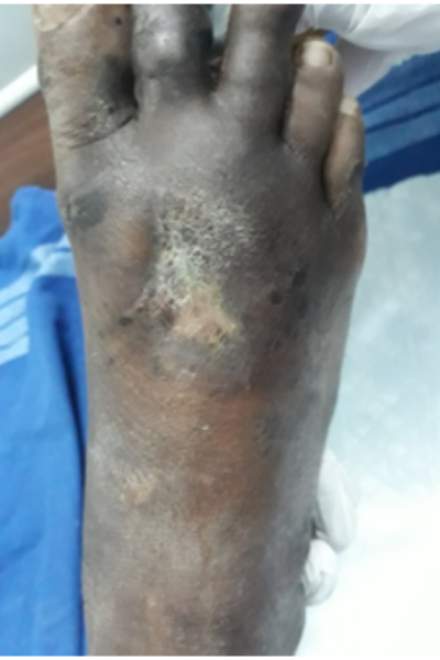 wellcare international hospital trichy wellcare international hospital trichy