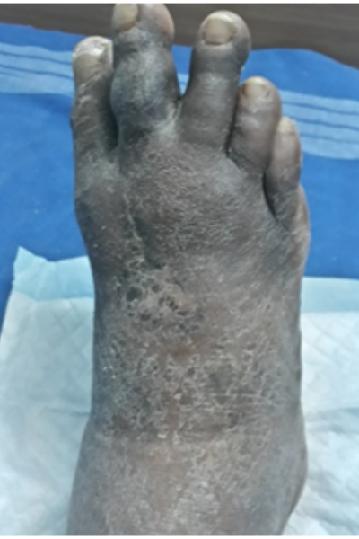 wellcare international hospital trichy wellcare international hospital trichy