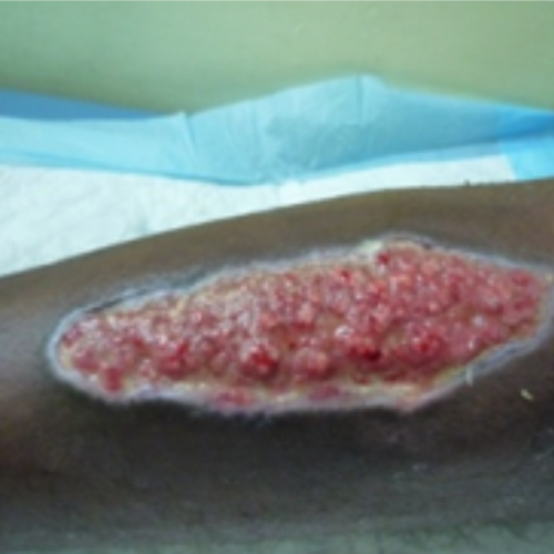wellcare international hospital trichy wellcare international hospital trichy