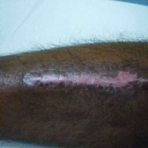 wellcare international hospital trichy wellcare international hospital trichy