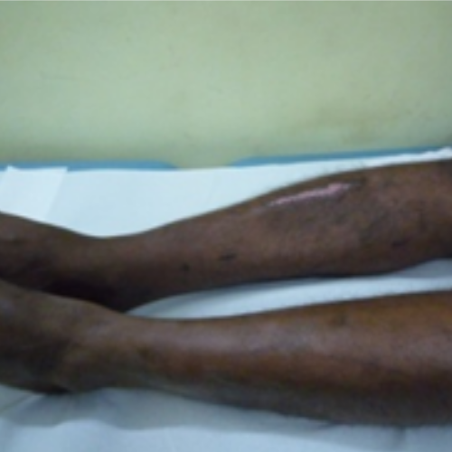 wellcare international hospital trichy wellcare international hospital trichy