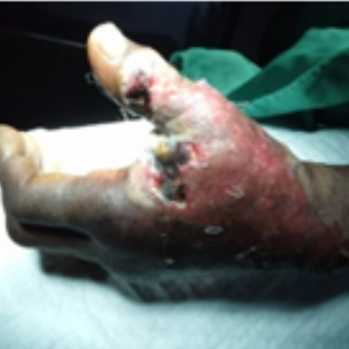 wellcare international hospital trichy wellcare international hospital trichy