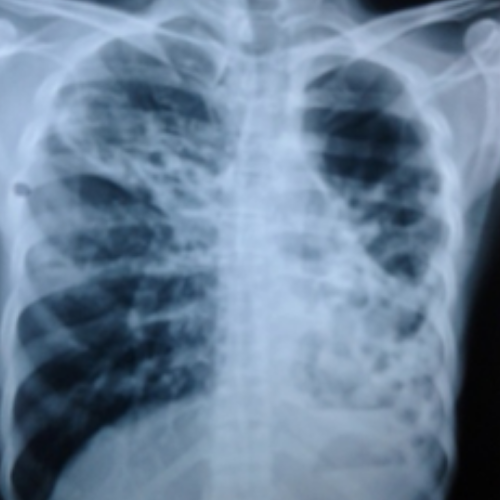 wellcare international hospital trichy wellcare international hospital trichy