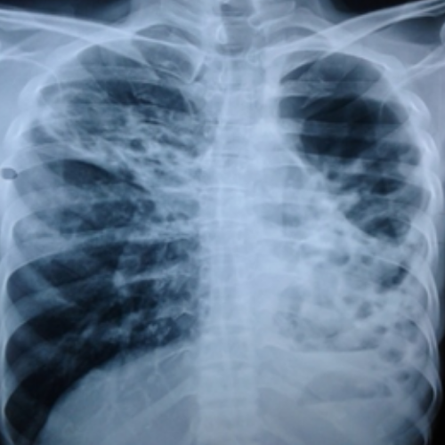 wellcare international hospital trichy wellcare international hospital trichy