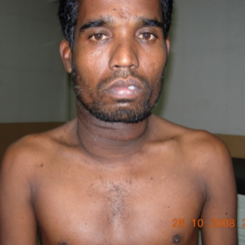 wellcare international hospital trichy wellcare international hospital trichy