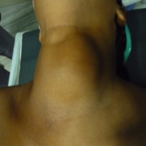 wellcare international hospital trichy wellcare international hospital trichy