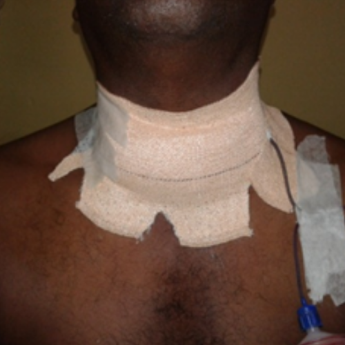 wellcare international hospital trichy wellcare international hospital trichy