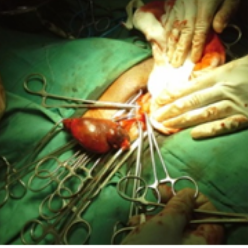 wellcare international hospital trichy wellcare international hospital trichy